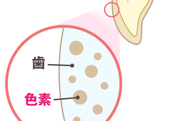 ホワイトニングをする前の歯の色