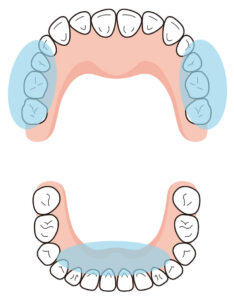 歯石がつきやすいところ