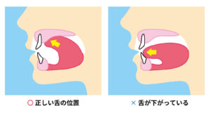 正しい舌の位置