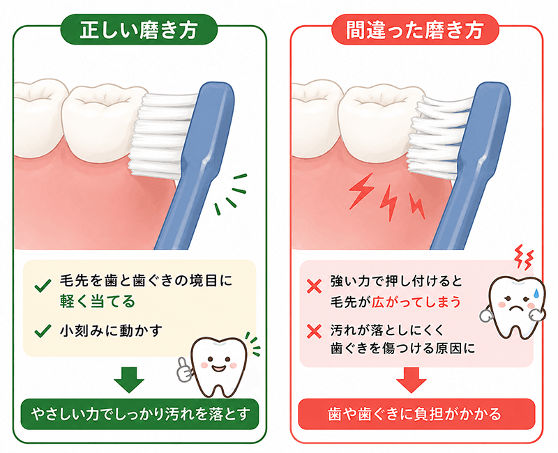 正しい磨き方と間違った磨き方の比較