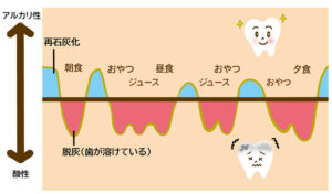 間食が多い人の場合の脱灰と再石灰化が行われるサイクル