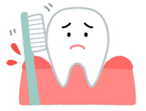 歯周病による歯茎からの出血